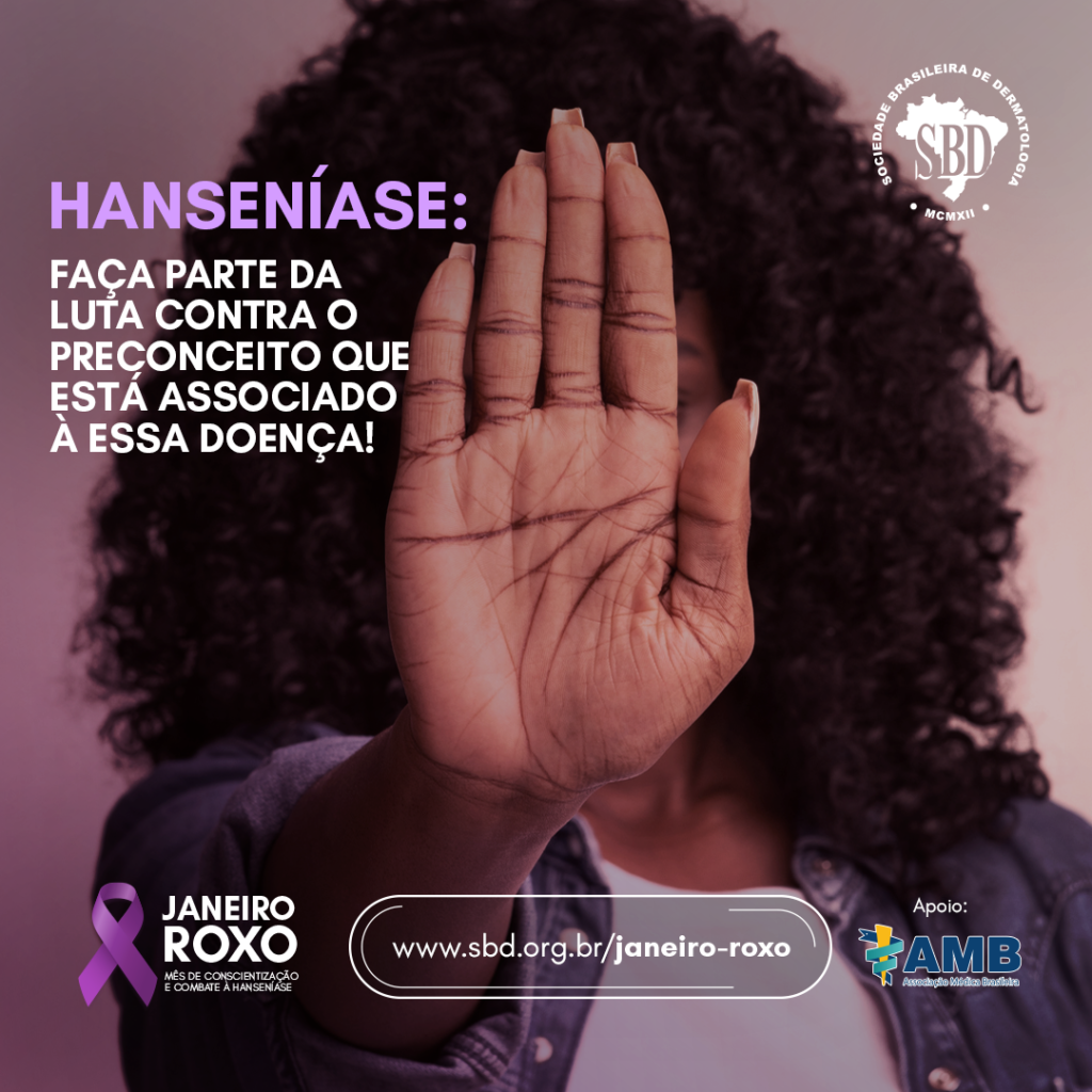 SBD: Janeiro Roxo – Hanseníase: Faça parte da luta contra o